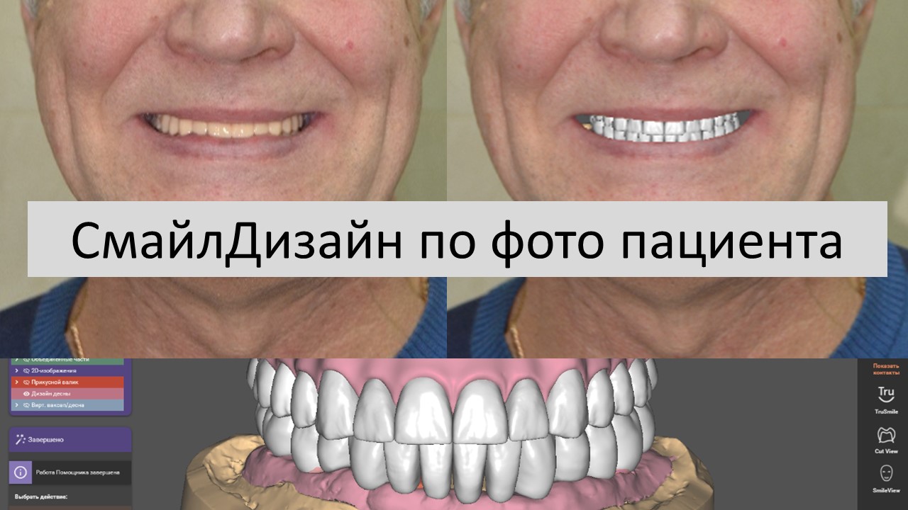 Celnnyj-cirkonCirkon-2.jpg