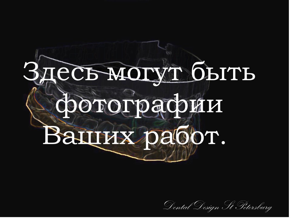 Бюгельное протезирование